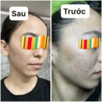 Ngâm Chân Thảo Dược – Bí Quyết Ngủ Ngon