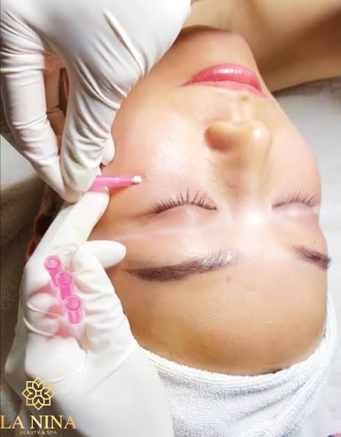 Cấy Sợi Collagen - Diamond Spa Yoga Gò Vấp