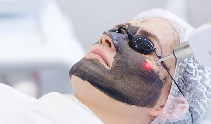 Hỗ Trợ Điều Trị Trắng Sáng Da Bằng Máy Công Nghệ Cao Bắn Carbon - Diamond Spa Yoga Gò Vấp
