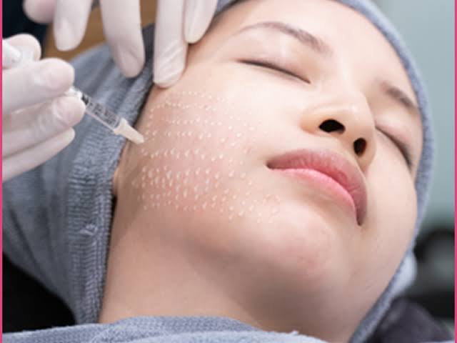 Liệu Trình Cấy Meso - Diamond Spa Yoga Gò Vấp