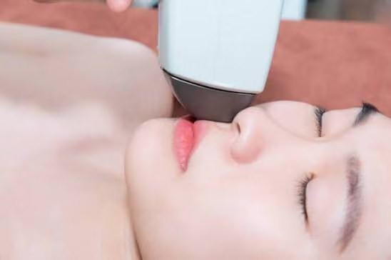 Triệt Lông Mép - Diamond Spa Yoga Gò Vấp