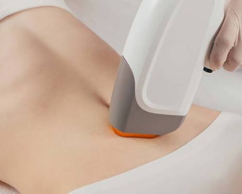 Triệt Lông Bụng - Diamond Spa Yoga Gò Vấp