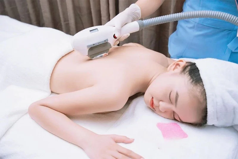 Triệt Lông Toàn Bộ Lưng - Diamond Spa Yoga Gò Vấp